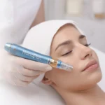 Kit Dermapen Nanopen Advance - Facial Integral - Imagen 6
