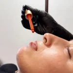 Kit Dermapen Nanopen BB Lips – Hidratación y Glow Labial - Imagen 4